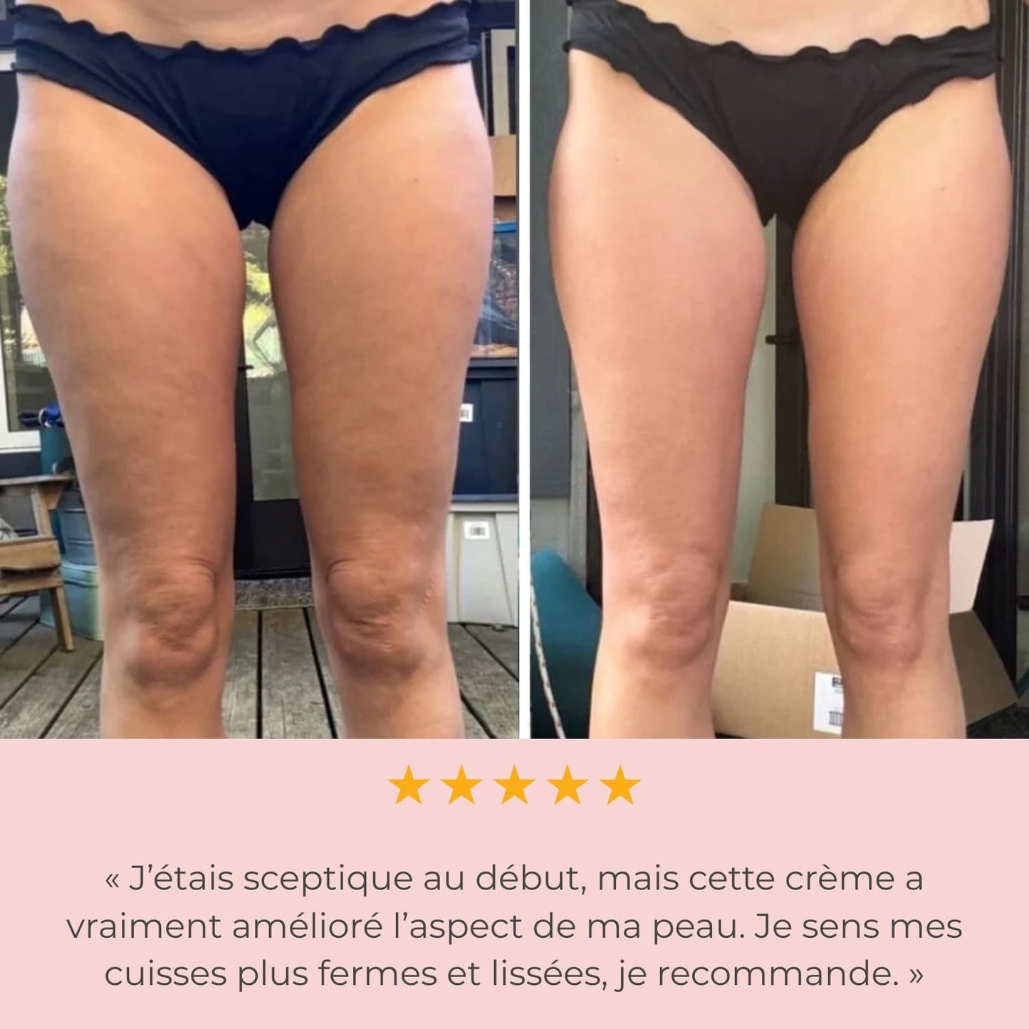 B-SMOOTH LIFT & FIRM BOOTY 🍑 CRÊME ANTI-CELLULITE